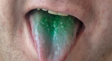 Myth of Green Tongues and dwi